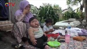 Kenzie, Balita Obesitas Mulai Membaik