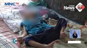 Bocah Kurang Gizi Sejak Lahir
