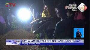 Bayi Kembar Siyam di Padang Meninggal