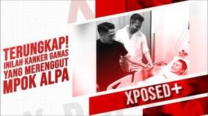Terungkap! Inilah Kanker Ganas yang Merenggut Mpok Alpa