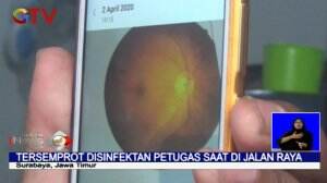 Kena Semprotan Disinfektan di Surabaya, Seorang Karyawan Mengalami Rabun Mata