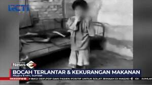 Kakak Beradik Yatim Piatu Kurang Gizi Dibawa ke RS