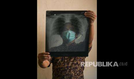 Studi: Senyawa yang Lindungi Sel Paru Dapat Blokir Covid-19