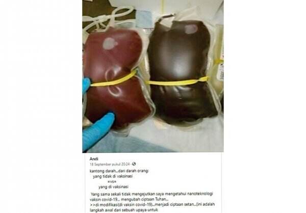 Vaksinasi Covid-19 Tidak Memengaruhi Warna Darah