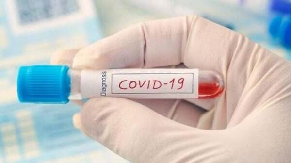 Virus Corona Varian Baru Muncul di Rusia, Lebih Menular Dibanding Delta