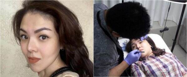 7 Jenis Perawatan Kecantikan Tina Toon, dari Botox hingga Sulam Bibir