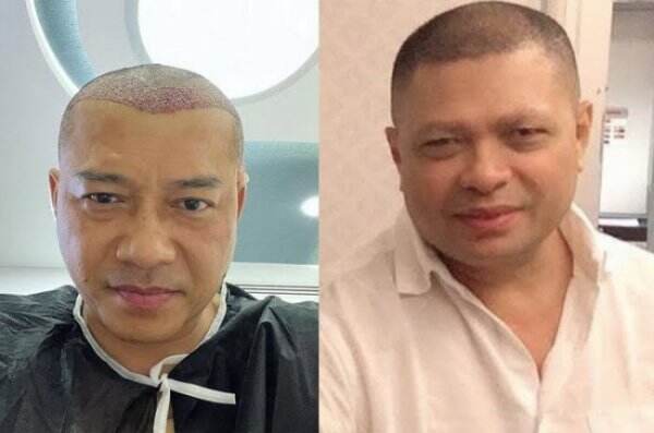 Unggah Foto Saat Botak, Anang Hermansyah Disebut Mirip Raul Lemos, Benar Gak Sih