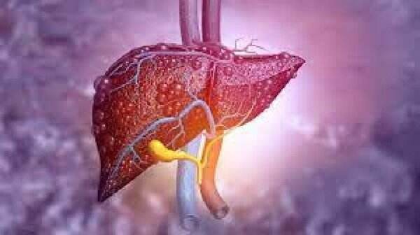 Begini Cara Mencegah Hepatitis dan Mengenali Penularannya