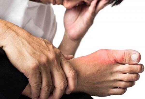 Ini Penyebab Bisul di Kaki, Bisa Jadi Gejala Diabetes Loh
