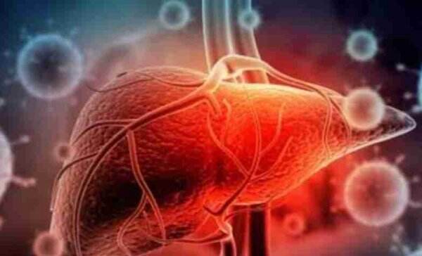 Ketahui, Ini Berbagai Jenis Hepatitis dan Cara Penularannya
