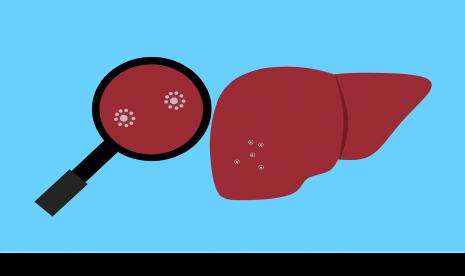 Dinkes Kota Depok Waspadai Penyebaran Virus Hepatitis Misterius
