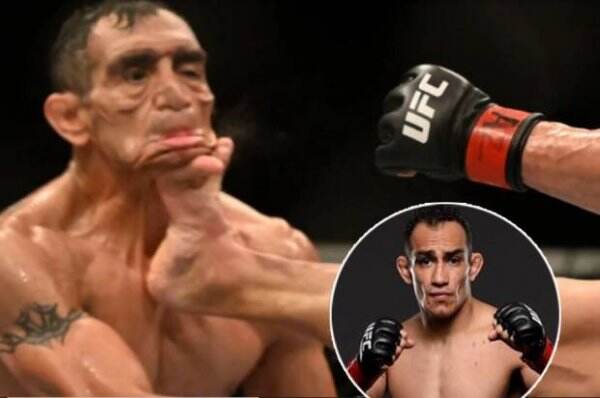 Petarung UFC Wajahnya Rusak Ditendang, Inilah Sosok Tony Ferguson