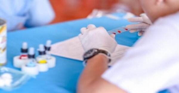 Anak 8 Tahun di Jakbar Diduga Meninggal karena Hepatitis Akut, Suka Makan Mi Instan dan Minum Soda