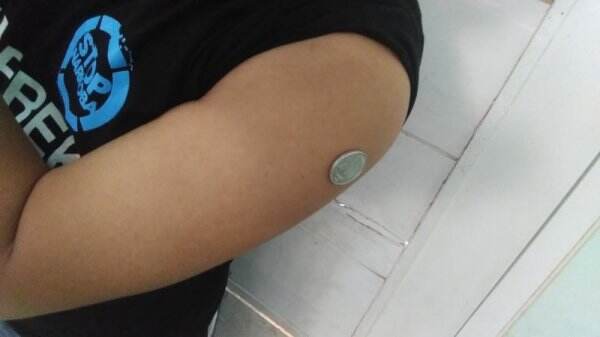 Apakah Vaksin Hepatitis yang Ada Sekarang Bisa Cegah Hepatitis Misterius? Begini Penjelasannya