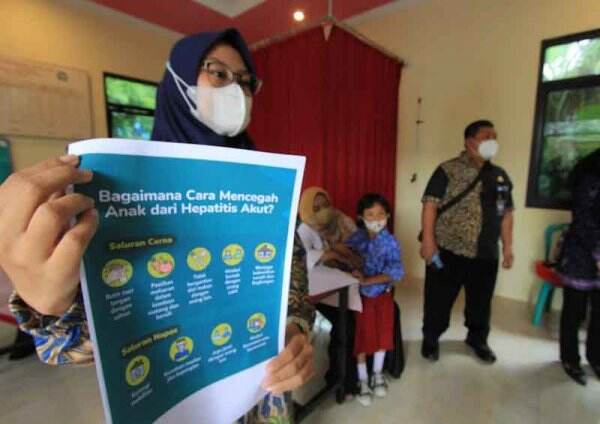 Ada Kabar Baik dari Kemenkes Soal Hepatitis Akut Misterius RI