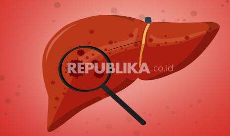 Yogya Belum Rencanakan Screening Deteksi Hepatitis Akut pada Anak