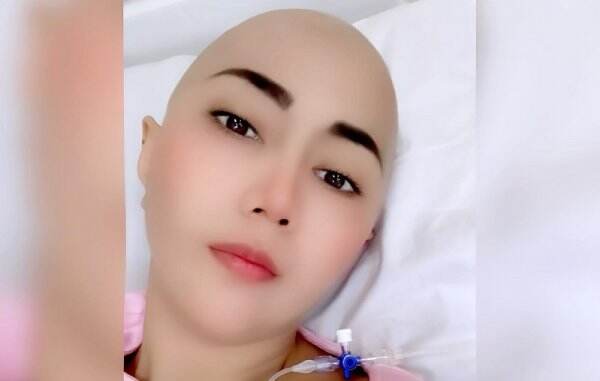 Down saat Divonis Kanker, Aida Saskia Takut Lumpuh