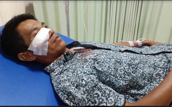 Pulang Yasinan Bendahara PWI Musi Rawas Dibegal, Motor Diramas Wajah Dibacok