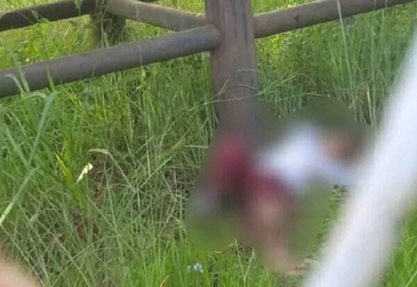 Kaki Bocah di Bengkalis Hancur Kena Pompa Milik PHR