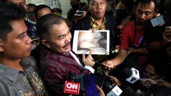 Brigadir J Dibunuh karena Disebut Bocorkan Informasi Kejahatan ke Atas, Pengacara Keluarga: Almarhum Ini Orang Baik