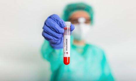 Jenis Baru Virus Cacar Monyet Terdeteksi di Inggris