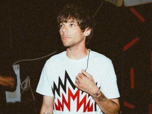 Louis Tomlinson Alami Patah Tulang Lengan Cukup Parah, Jatuh Pulang Konser