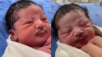 Viral Video Bayi Baru Lahir Diduga Berkumis Tebal, Ini Faktanya! Viral Video Bayi Baru Lahir Diduga Berkumis Tebal, Ini Faktanya!