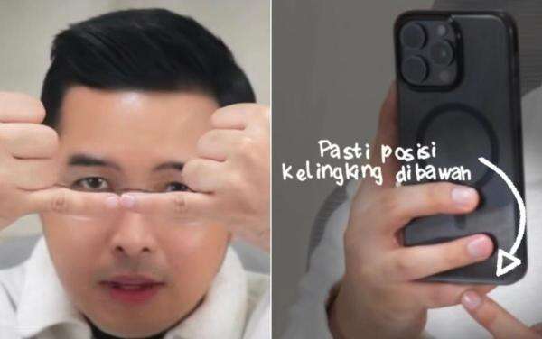 Sering Pegang HP Pakai Jari Kelingking? Dokter Ungkap Risikonya Bikin Jari Berubah Bentuk Sering Pegang HP Pakai Jari Kelingking? Dokter Ungkap Risikonya Bikin Jari Berubah Bentuk