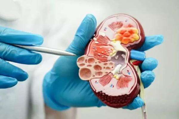 Menahan Kencing Bisa Rusak Ginjal Ternyata Bukan Mitos, Ini Penjelasan Dokter Menahan Kencing Bisa Rusak Ginjal Ternyata Bukan Mitos, Ini Penjelasan Dokter