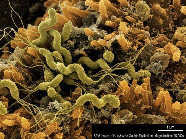 Apa Itu Bakteri H. pylori yang Menginfeksi Sandrinna Michelle? Ini Jawabannya! Apa Itu Bakteri H. pylori yang Menginfeksi Sandrinna Michelle? Ini Jawabannya!