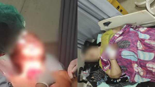 Dipicu Perceraian Adat, Menantu Bacok Mertua di Barito Utara: Ini Kronologinya Dipicu Perceraian Adat, Menantu Bacok Mertua di Barito Utara: Ini Kronologinya