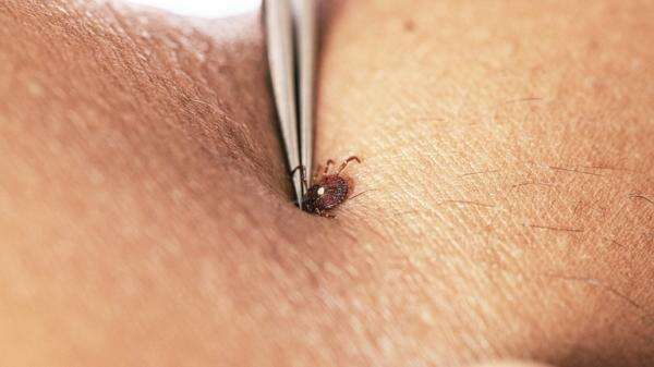 Virus Langka yang Belum Ada Obatnya Terkonfirmasi Muncul di New York Virus Langka yang Belum Ada Obatnya Terkonfirmasi Muncul di New York