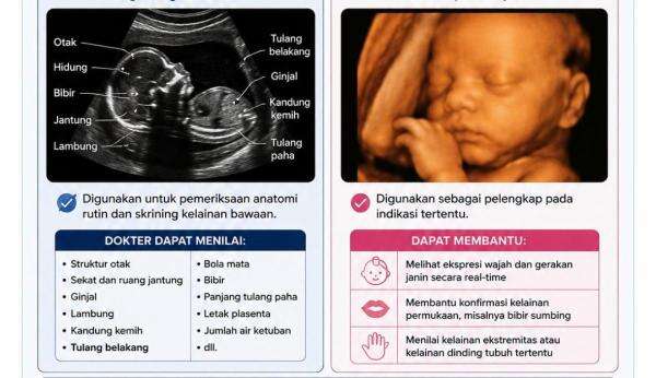 Sering Dianggap Ketinggalan, USG 2D Ternyata Lebih Akurat Deteksi Kelainan Janin Sering Dianggap Ketinggalan, USG 2D Ternyata Lebih Akurat Deteksi Kelainan Janin