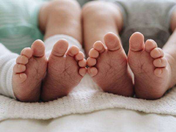 Kondisi Terkini Bayi Kembar Siam yang Dipisahkan di RSCM, Jalani Pemulihan Terpisah Kondisi Terkini Bayi Kembar Siam yang Dipisahkan di RSCM, Jalani Pemulihan Terpisah