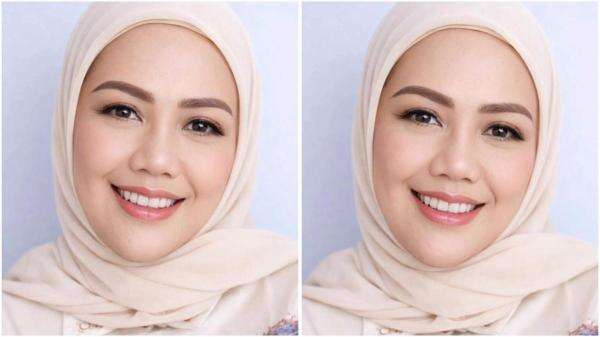 Heboh! Elly Sugigi Hanya Incar Pria Ganteng untuk Dinikahi usai Oplas Hidung Heboh! Elly Sugigi Hanya Incar Pria Ganteng untuk Dinikahi usai Oplas Hidung