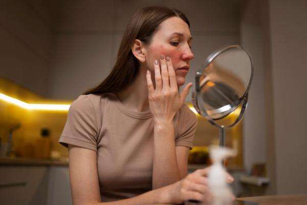 3 Tips Merawat Kulit Sensitif, dari Pilih Skincare hingga Pakai Tabir Surya 3 Tips Merawat Kulit Sensitif, dari Pilih Skincare hingga Pakai Tabir Surya