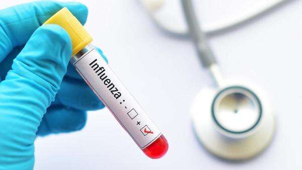 Dokter Beberkan Proses Virus Infuenza A Masuk ke Tubuh dan Picu Gejala Sistemik Dokter Beberkan Proses Virus Infuenza A Masuk ke Tubuh dan Picu Gejala Sistemik