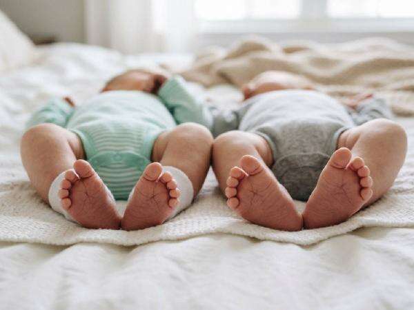 RSCM Sukses Pisahkan Bayi Kembar Siam Dempet Perut Lewat Operasi 36 Jam RSCM Sukses Pisahkan Bayi Kembar Siam Dempet Perut Lewat Operasi 36 Jam
