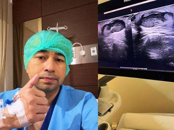 Raffi Ahmad Ternyata Punya Benjolan di Bahu, Selama Ini Disembunyikan! Raffi Ahmad Ternyata Punya Benjolan di Bahu, Selama Ini Disembunyikan!
