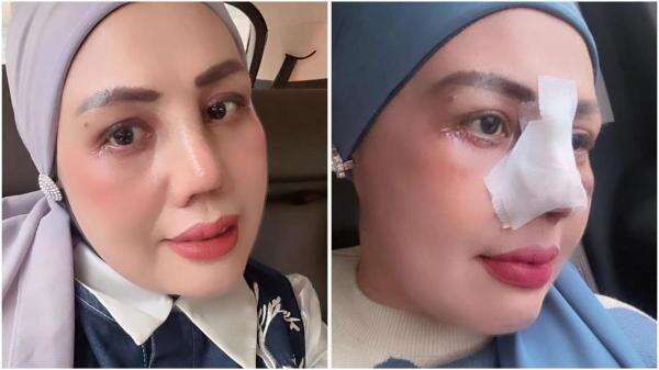 Elly Sugigi Habiskan Rp65 Juta untuk Oplas Hidung dan Mata, Akui Lelah Dihina! Elly Sugigi Habiskan Rp65 Juta untuk Oplas Hidung dan Mata, Akui Lelah Dihina!