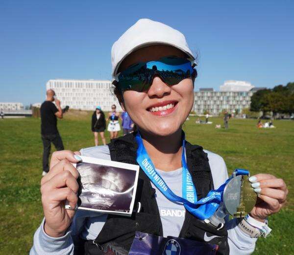 Kisah Luar Biasa Agnes Yuliavitriani, Tuntaskan Berlin Marathon 2026 dalam Kondisi Hamil Kisah Luar Biasa Agnes Yuliavitriani, Tuntaskan Berlin Marathon 2026 dalam Kondisi Hamil