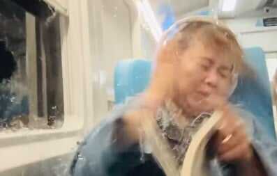 Wajah Terluka akibat Lemparan Batu di Kereta, Widya Imbau Penumpang KA Gorden Tutup agar Aman Wajah Terluka akibat Lemparan Batu di Kereta, Widya Imbau Penumpang KA Gorden Tutup agar Aman