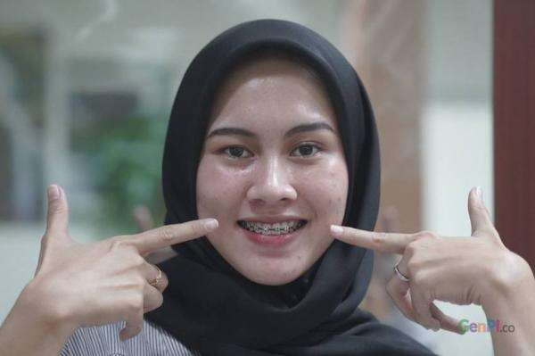 Apakah Punya Gigi Tak Rapi Bisa Daftar PKN STAN? Simak Penjelasan ...