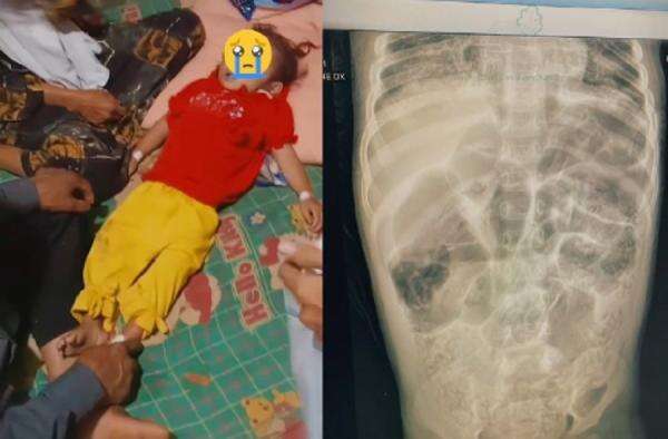 Viral! Balita Meninggal Tubuhnya Dipenuhi Ratusan Cacing, Ibunya ODGJ Ayahnya TBC Viral! Balita Meninggal Tubuhnya Dipenuhi Ratusan Cacing, Ibunya ODGJ Ayahnya TBC