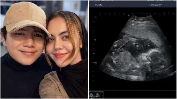 Ratu Rizky Nabila Umumkan Segera Melahirkan Anak Pesulap Merah: Mohon Doa Terbaik Ratu Rizky Nabila Umumkan Segera Melahirkan Anak Pesulap Merah: Mohon Doa Terbaik
