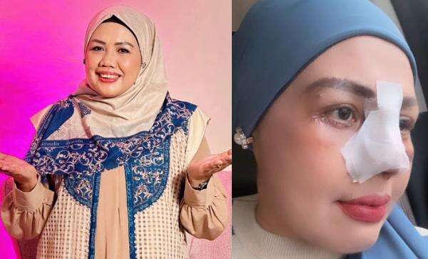 Potret Terkini Elly Sugigi Usai Operasi Plastik Potret Terkini Elly Sugigi Usai Operasi Plastik