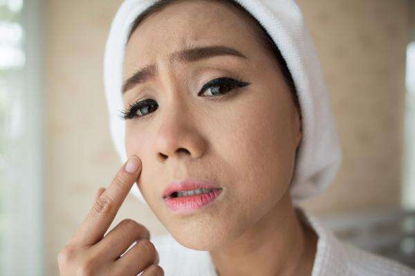 8 Tanda Kulit saat Kamu Sedang Stres, Yuk Simak Cara Mengatasinya! 8 Tanda Kulit saat Kamu Sedang Stres, Yuk Simak Cara Mengatasinya!
