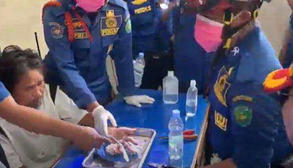 Dramatis, Aksi Petugas Damkar Bengkulu Lepas 18 Cincin dari Jari Pasien ODGJ