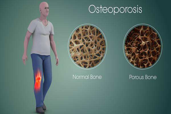 7 Makanan yang Baik Untuk Otot dan Bisa Cegah Osteoporosis