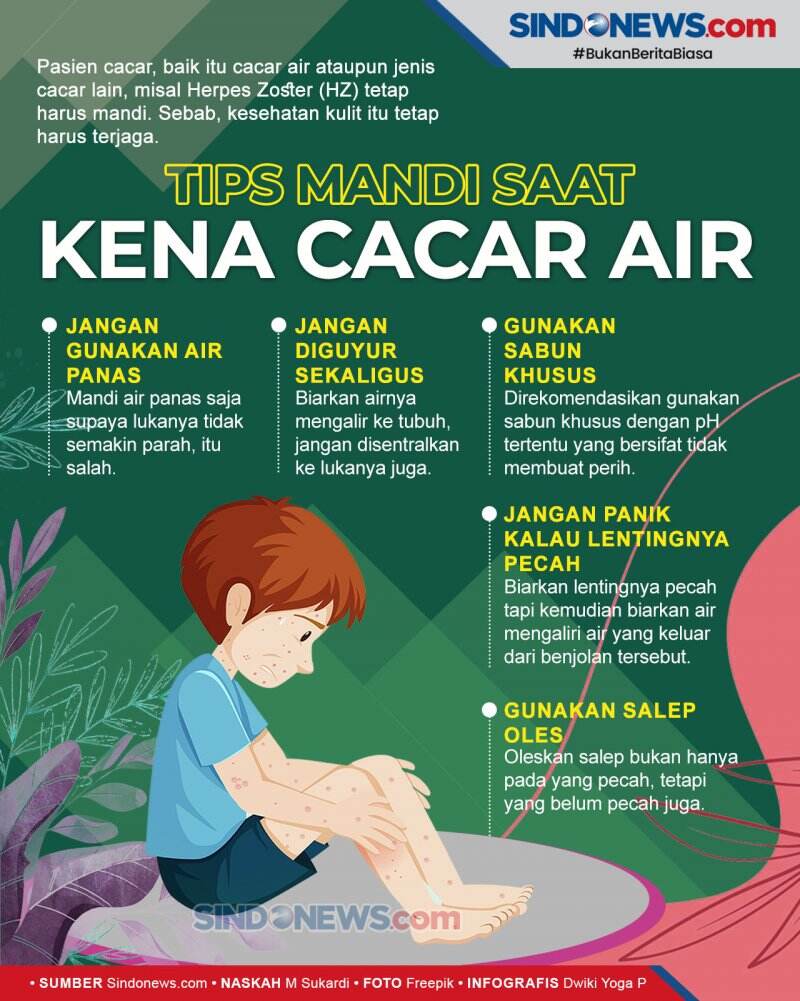 Penderita Cacar Air Justru Disarankan Dokter untuk Mandi